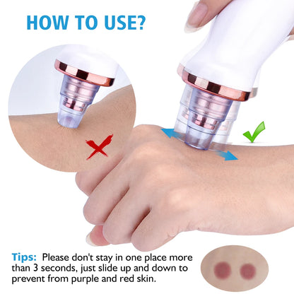 Vacuum Blackhead Removal