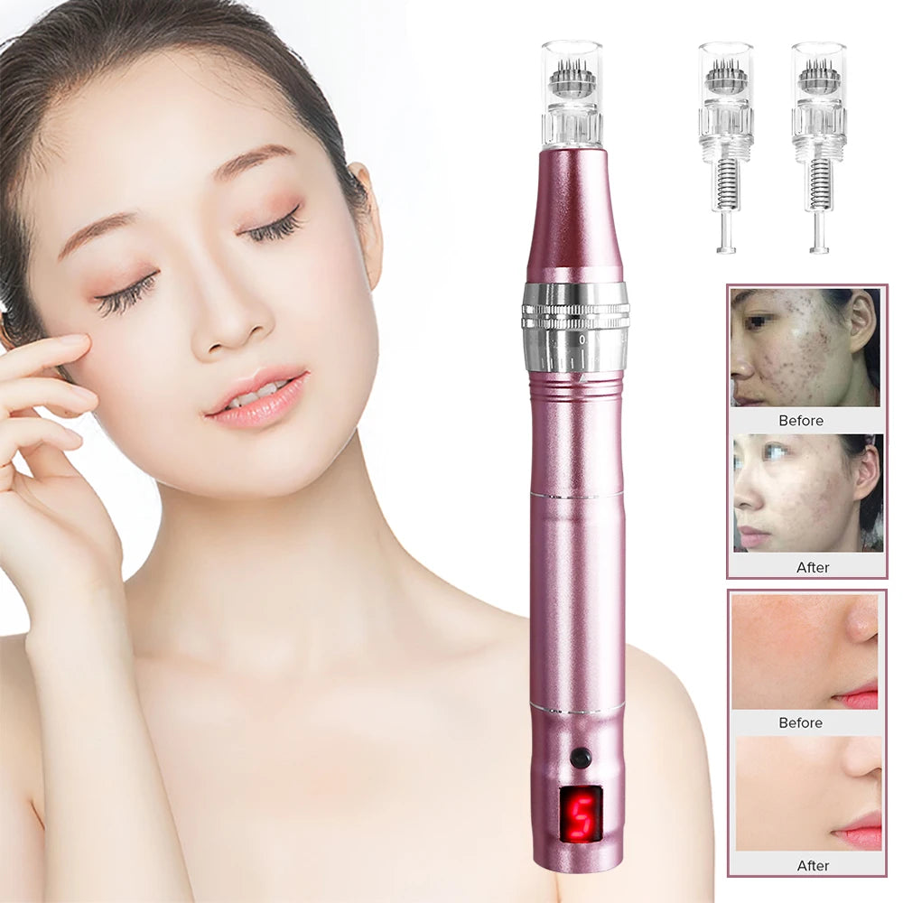Wireless High-Frequency Skin Tightener