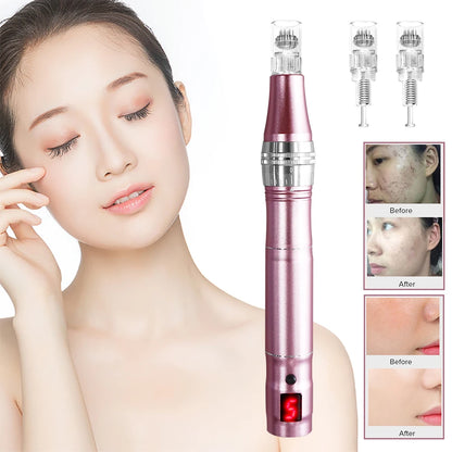 Wireless High-Frequency Skin Tightener