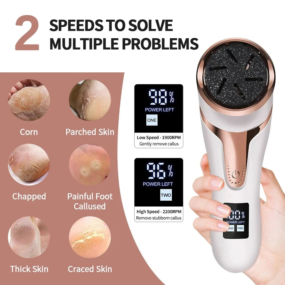 Foot Callus Remover Tool